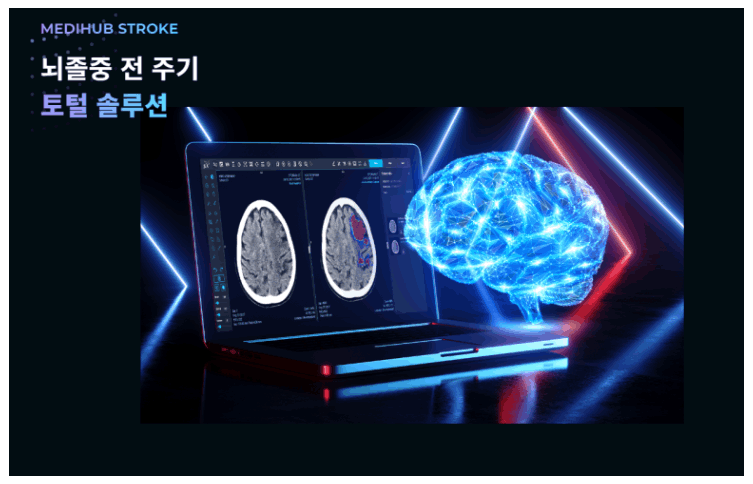 AI의료기업 제이엘케이 : 뇌졸중 AI 솔루션(JBS-01K등), 제2의 유니콘 Viz.ai社 꿈꾸다