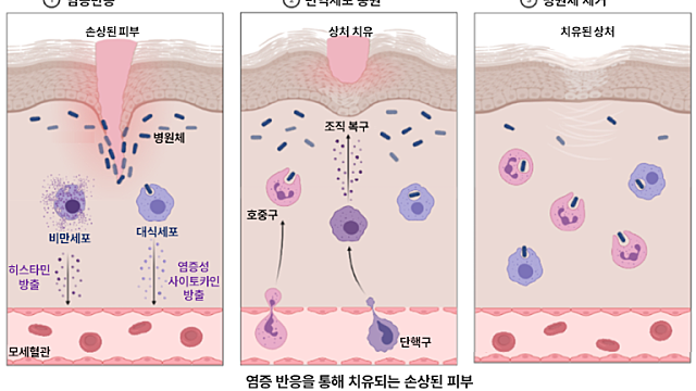 착한 염증, 나쁜 염증