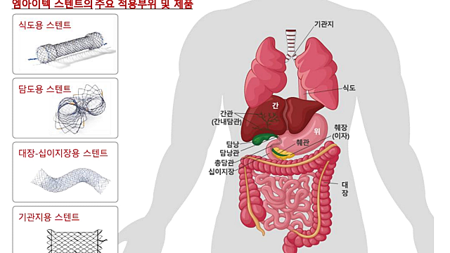 [엠아이텍] 숨은 강자와 수출데이터