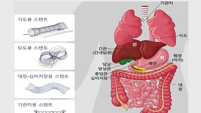 [엠아이텍] 단기 모멘텀과 구조적 성장이 동시에 존재하는 주식 (feat. 자진상폐)