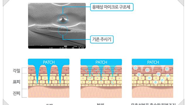 라파스 - 마이크로 니들(Micro Niddle) 관련주로 부각받는 세계 유일의 기업